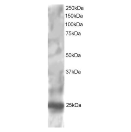 Western Blot - Anti-RGS1 Antibody (A83832) - Antibodies.com