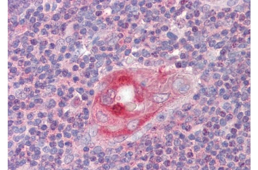 Immunohistochemistry - Anti-RGS1 Antibody (A83832) - Antibodies.com