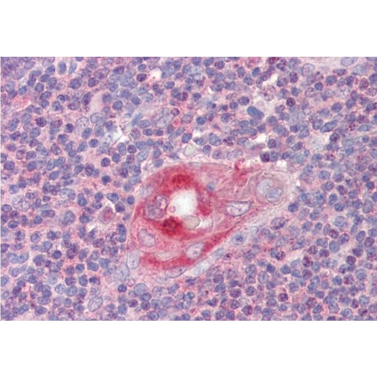 Immunohistochemistry - Anti-RGS1 Antibody (A83832) - Antibodies.com