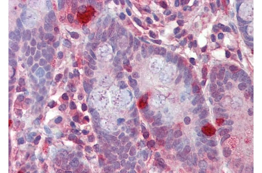 Immunohistochemistry - Anti-RGS1 Antibody (A83832) - Antibodies.com