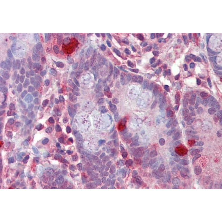 Immunohistochemistry - Anti-RGS1 Antibody (A83832) - Antibodies.com