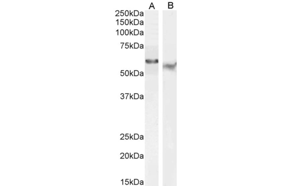 Western Blot - Anti-TFEB Antibody (A83834) - Antibodies.com