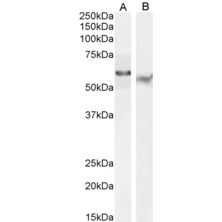 Western Blot - Anti-TFEB Antibody (A83834) - Antibodies.com