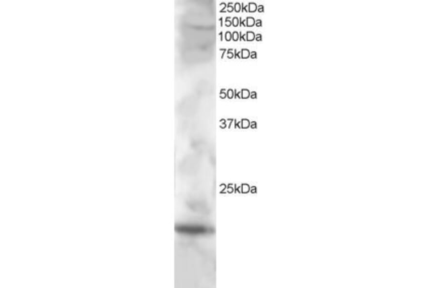 Western Blot - Anti-CST7 Antibody (A83836) - Antibodies.com