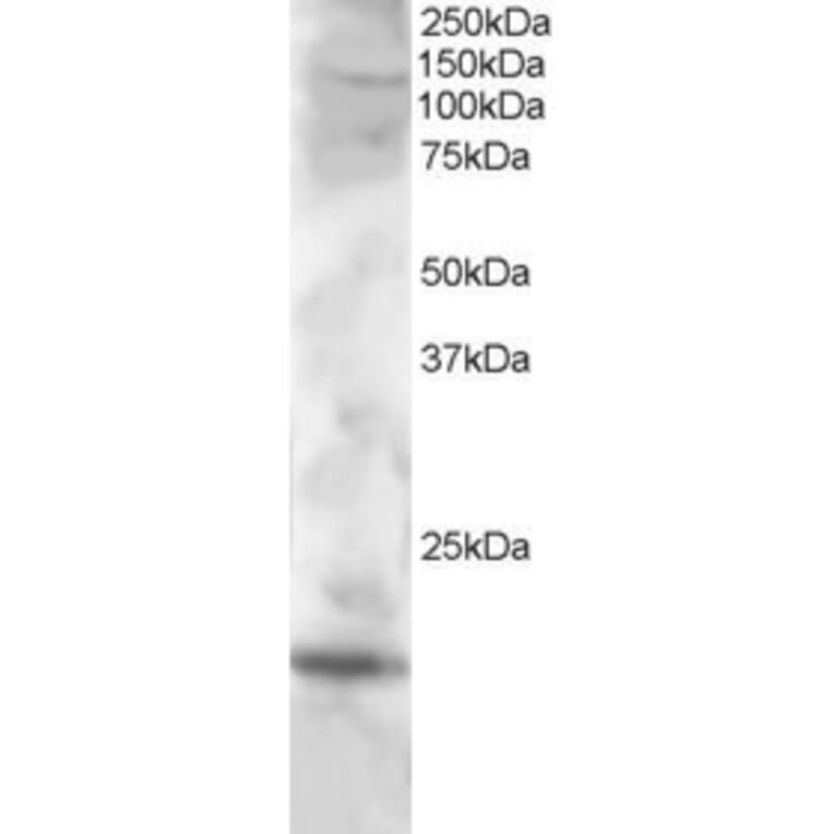 Western Blot - Anti-CST7 Antibody (A83836) - Antibodies.com