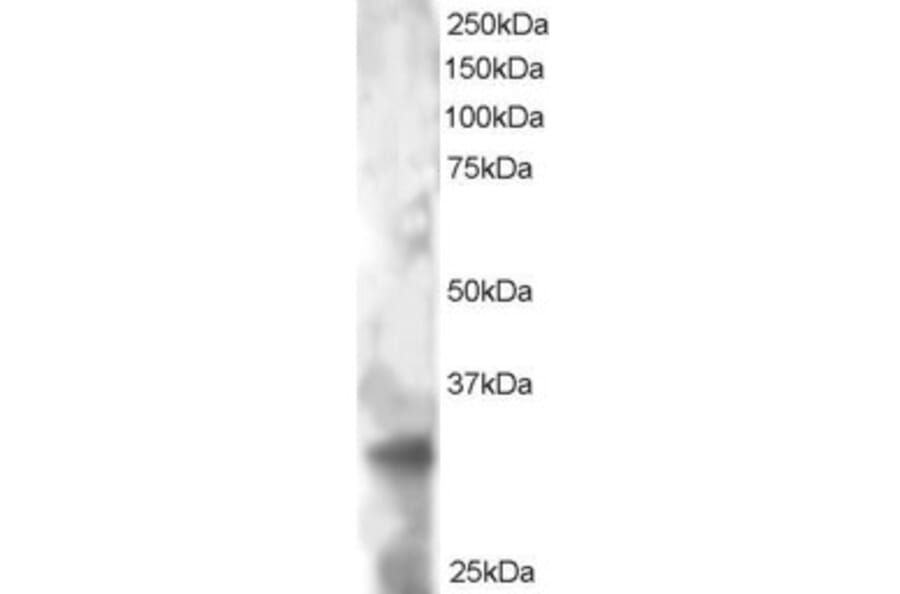 Western Blot - Anti-PHEMX/TSPAN32 Antibody (A83837) - Antibodies.com