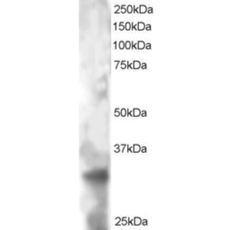 Western Blot - Anti-PHEMX/TSPAN32 Antibody (A83837) - Antibodies.com