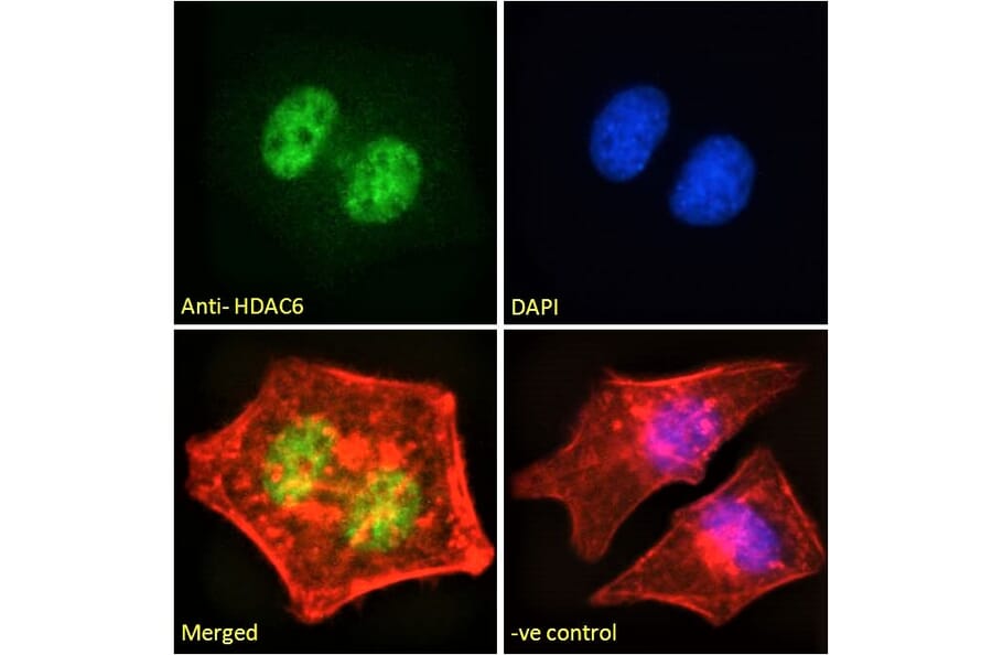 Immunofluorescence - Anti-HDAC6 Antibody (A83838) - Antibodies.com