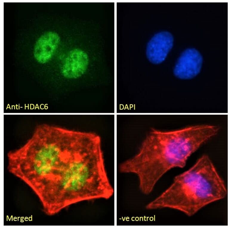Immunofluorescence - Anti-HDAC6 Antibody (A83838) - Antibodies.com
