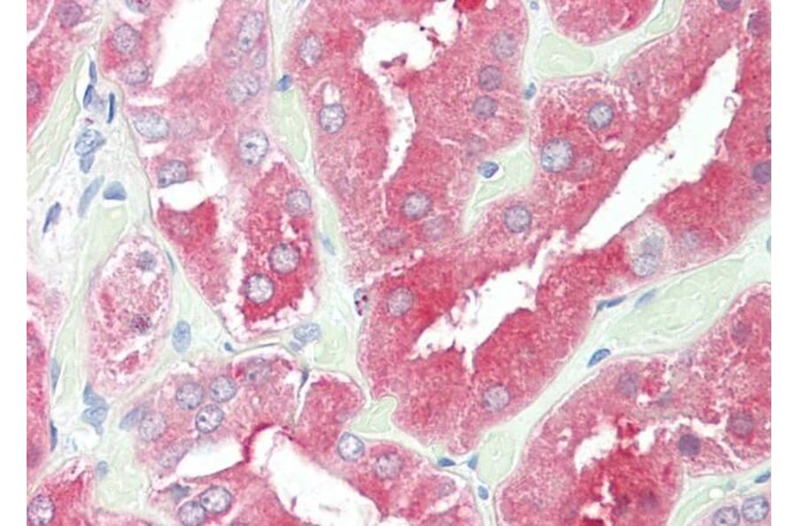 Immunohistochemistry - Anti-HDAC6 Antibody (A83838) - Antibodies.com