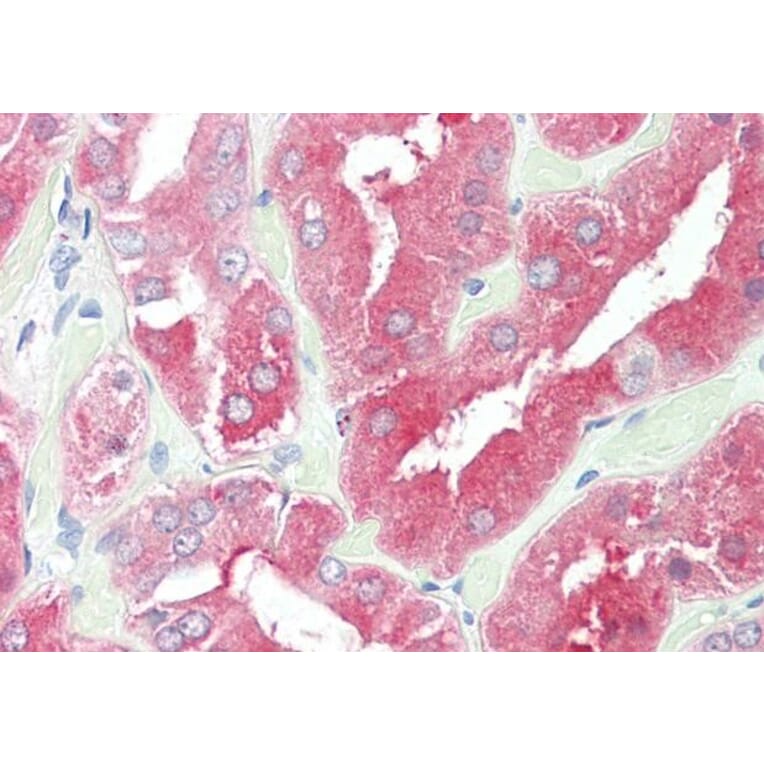 Immunohistochemistry - Anti-HDAC6 Antibody (A83838) - Antibodies.com