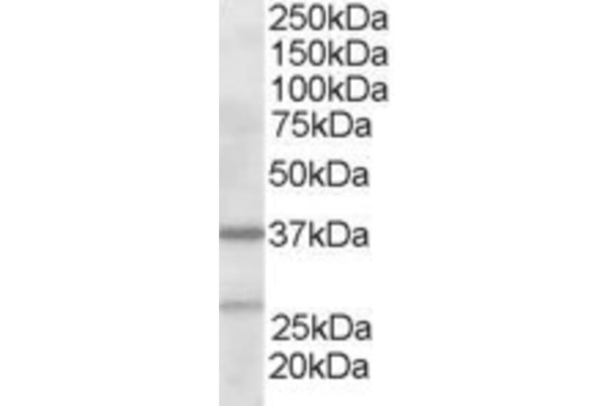 Western Blot - Anti-ARPC1B Antibody (A83839) - Antibodies.com