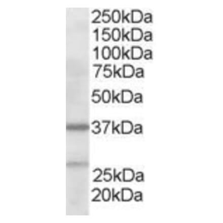 Western Blot - Anti-ARPC1B Antibody (A83839) - Antibodies.com
