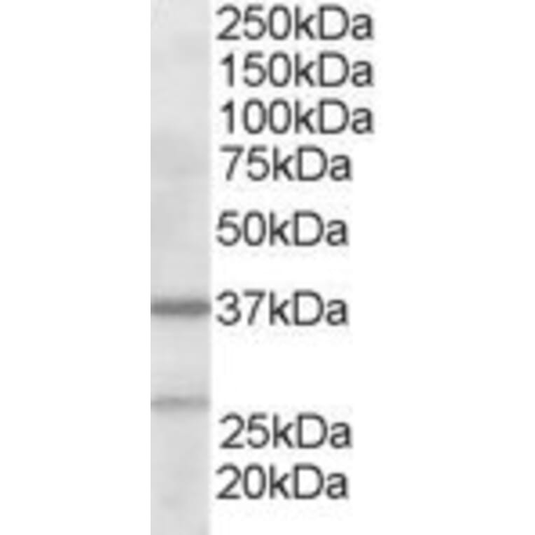 Western Blot - Anti-ARPC1B Antibody (A83839) - Antibodies.com