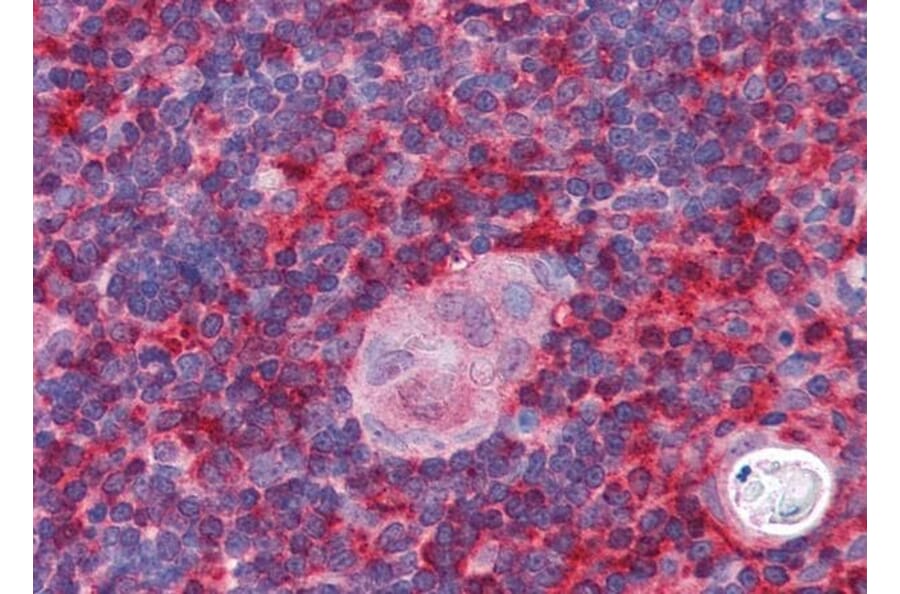 Immunohistochemistry - Anti-ARPC1B Antibody (A83839) - Antibodies.com