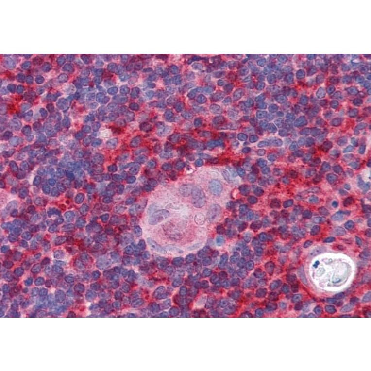 Immunohistochemistry - Anti-ARPC1B Antibody (A83839) - Antibodies.com