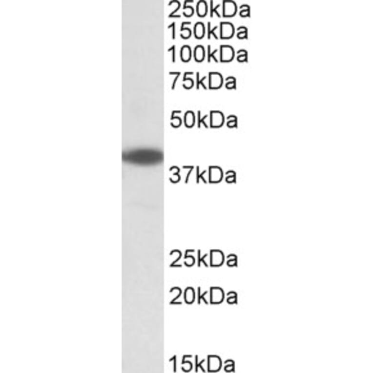 Western Blot - Anti-LIS1 Antibody (A83840) - Antibodies.com