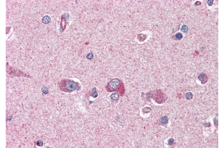 Immunohistochemistry - Anti-LIS1 Antibody (A83840) - Antibodies.com