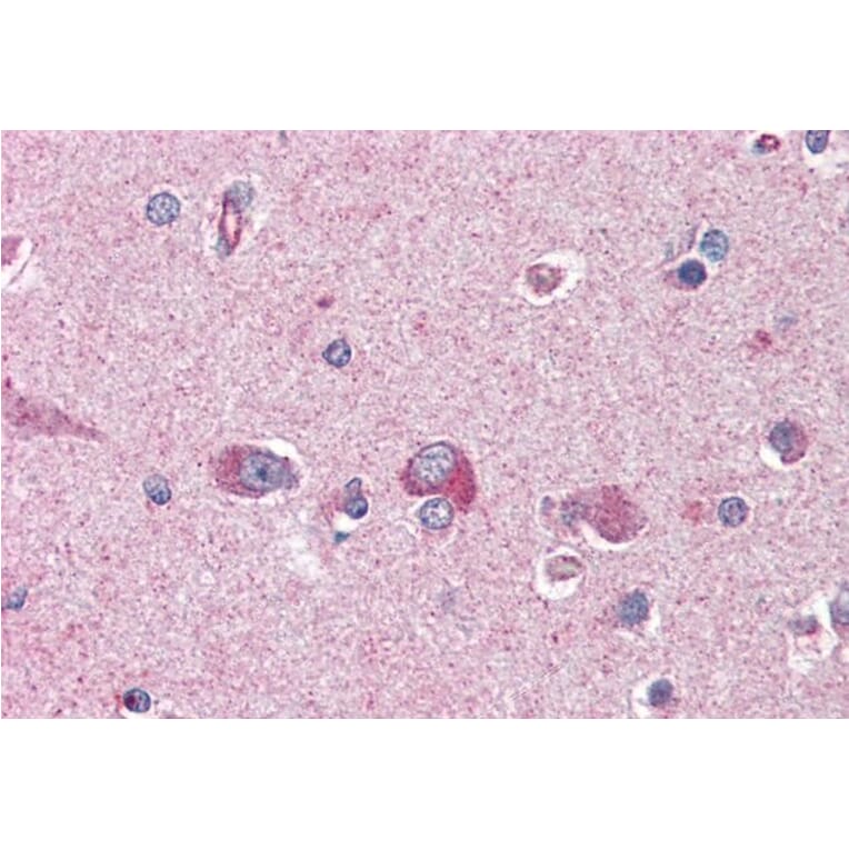 Immunohistochemistry - Anti-LIS1 Antibody (A83840) - Antibodies.com
