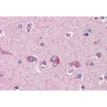 Immunohistochemistry - Anti-LIS1 Antibody (A83840) - Antibodies.com