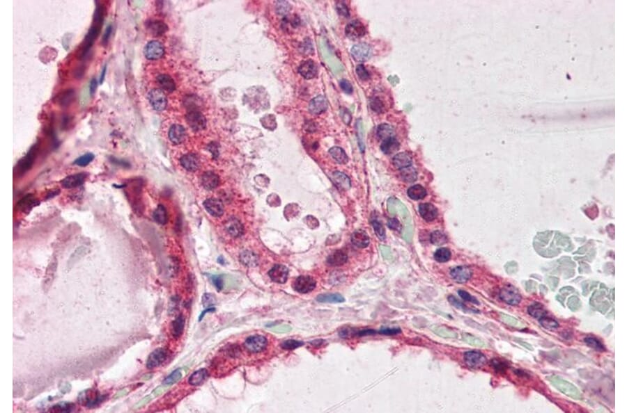 Immunohistochemistry - Anti-LIS1 Antibody (A83840) - Antibodies.com