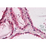 Immunohistochemistry - Anti-LIS1 Antibody (A83840) - Antibodies.com
