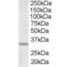 Western Blot - Anti-ING2 Antibody (A83844) - Antibodies.com