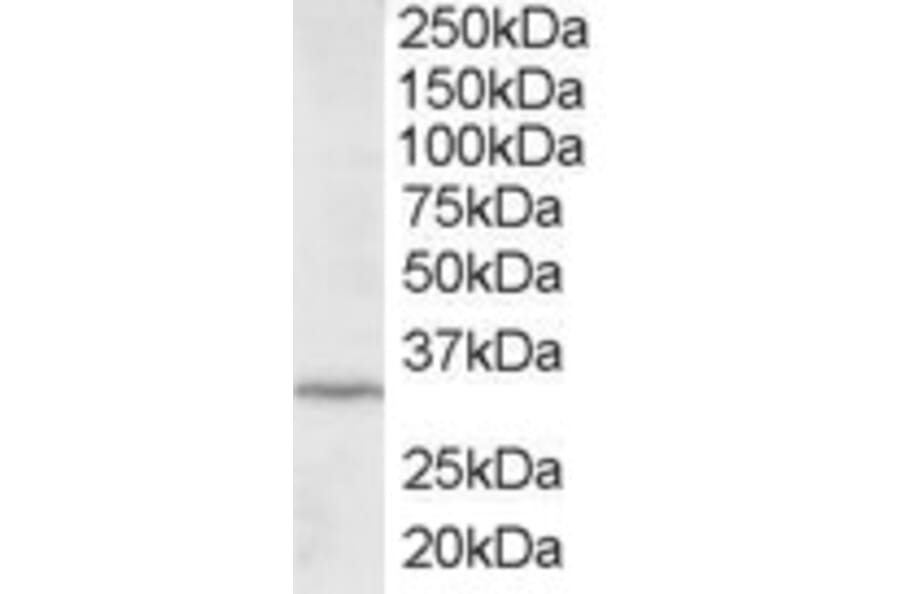 Western Blot - Anti-ING2 Antibody (A83844) - Antibodies.com