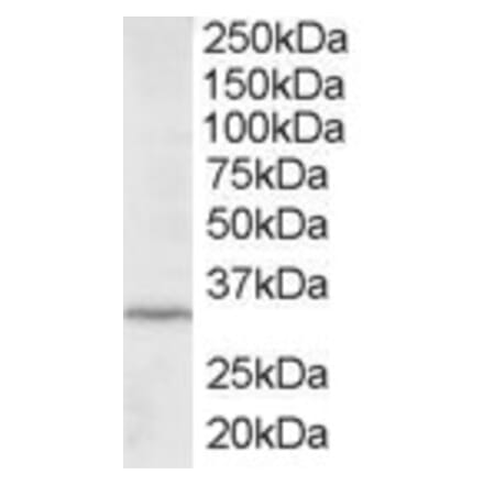 Western Blot - Anti-ING2 Antibody (A83844) - Antibodies.com