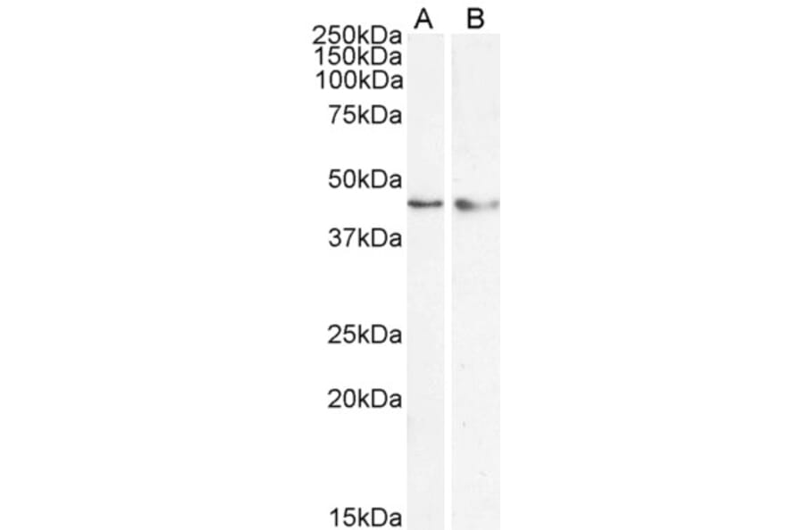 Western Blot - Anti-KLF15 Antibody (A83845) - Antibodies.com