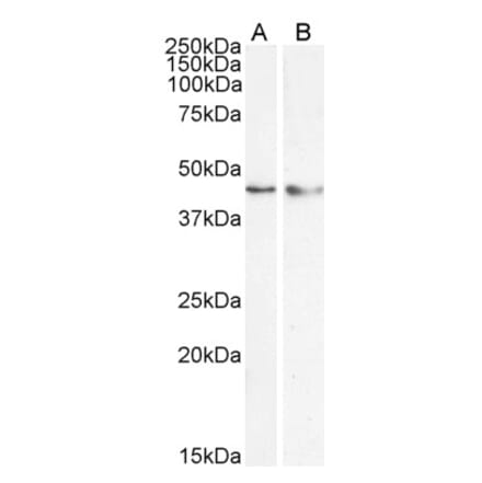 Western Blot - Anti-KLF15 Antibody (A83845) - Antibodies.com