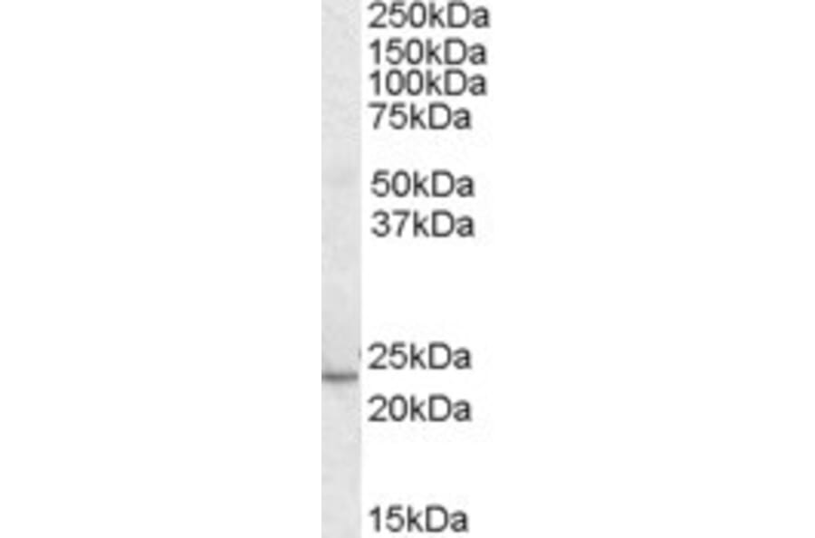 Western Blot - Anti-KLF16 Antibody (A83846) - Antibodies.com