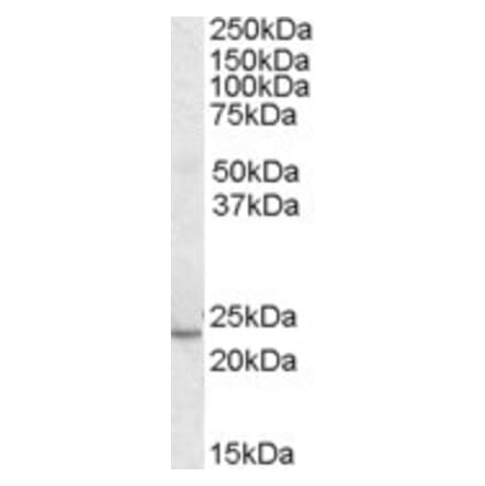 Western Blot - Anti-KLF16 Antibody (A83846) - Antibodies.com