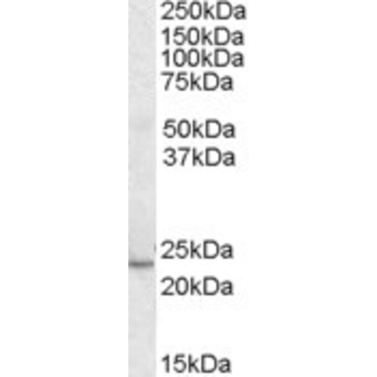 Western Blot - Anti-KLF16 Antibody (A83846) - Antibodies.com