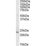 Western Blot - Anti-KLF16 Antibody (A83846) - Antibodies.com