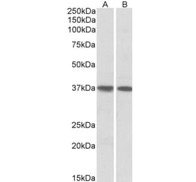 Western Blot - Anti-KLF2 Antibody (A83848) - Antibodies.com