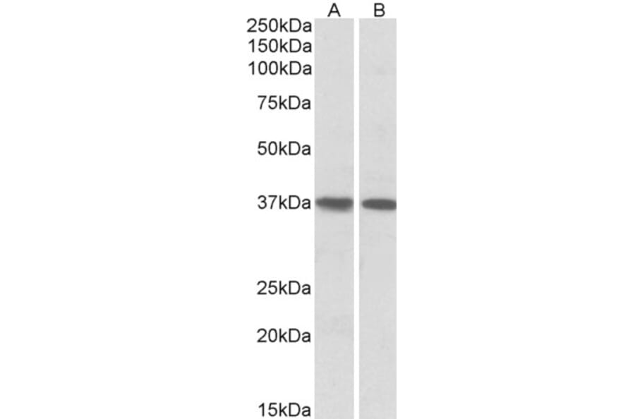 Western Blot - Anti-KLF2 Antibody (A83848) - Antibodies.com
