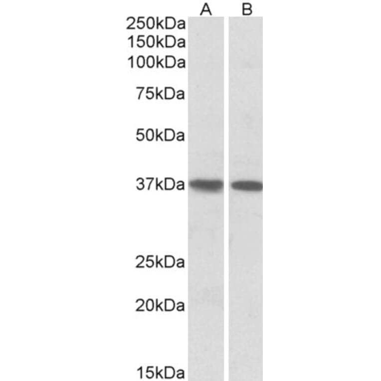 Western Blot - Anti-KLF2 Antibody (A83848) - Antibodies.com