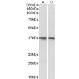 Western Blot - Anti-KLF2 Antibody (A83848) - Antibodies.com