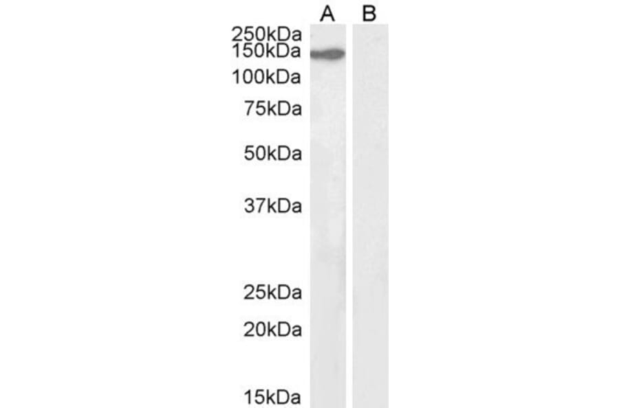 Western Blot - Anti-KIF4A/KIF4 Antibody (A83849) - Antibodies.com