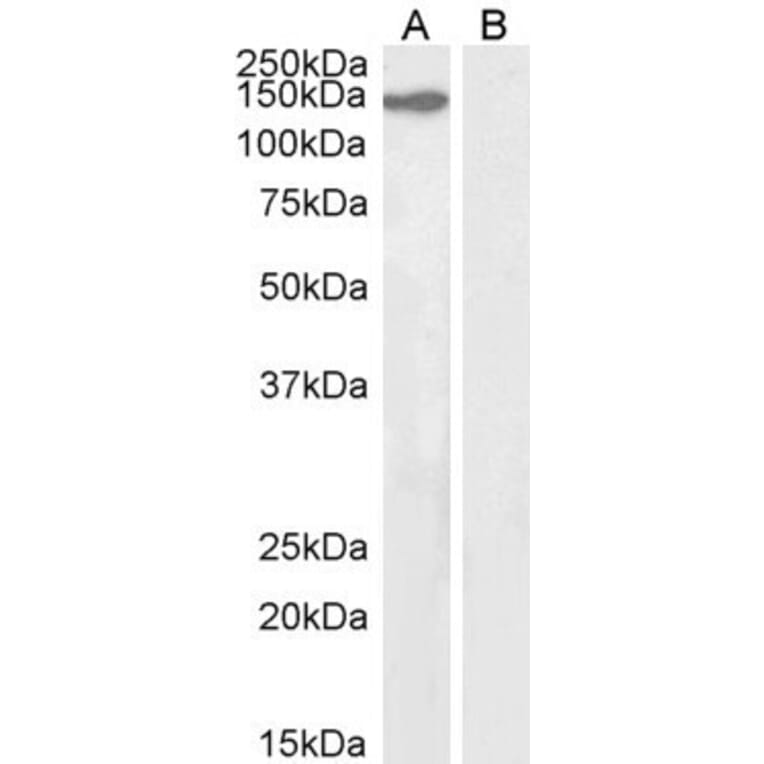 Western Blot - Anti-KIF4A/KIF4 Antibody (A83849) - Antibodies.com