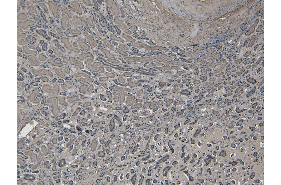 Immunohistochemistry - Anti-Bag3 Antibody (A83851) - Antibodies.com