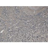 Immunohistochemistry - Anti-Bag3 Antibody (A83851) - Antibodies.com