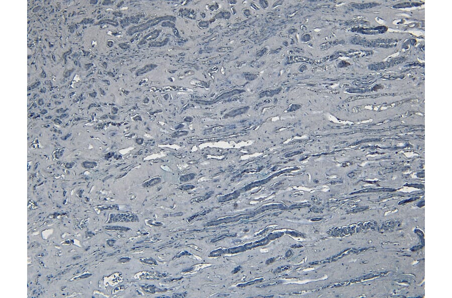 Immunohistochemistry - Anti-Bag3 Antibody (A83851) - Antibodies.com