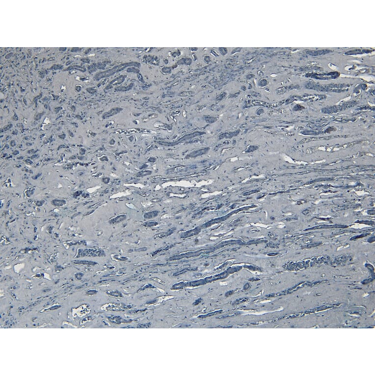 Immunohistochemistry - Anti-Bag3 Antibody (A83851) - Antibodies.com