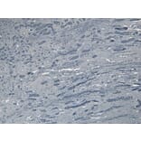 Immunohistochemistry - Anti-Bag3 Antibody (A83851) - Antibodies.com