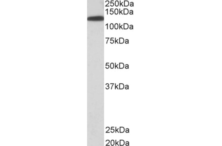 Western Blot - Anti-KIF5B Antibody (A83852) - Antibodies.com