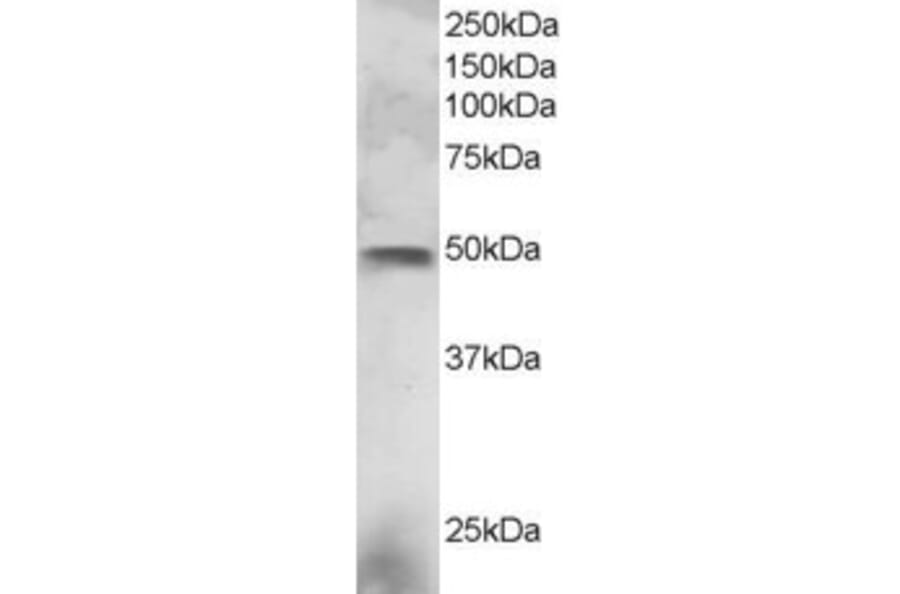Western Blot - Anti-ESE1 Antibody (A83854) - Antibodies.com