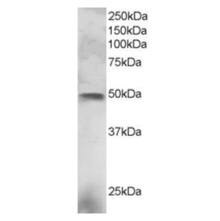 Western Blot - Anti-ESE1 Antibody (A83854) - Antibodies.com