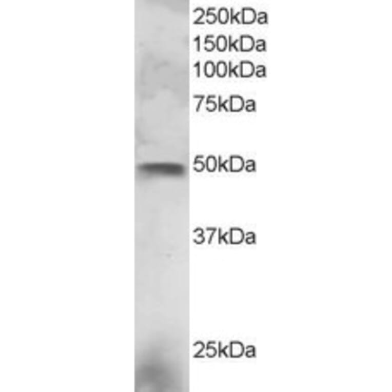 Western Blot - Anti-ESE1 Antibody (A83854) - Antibodies.com